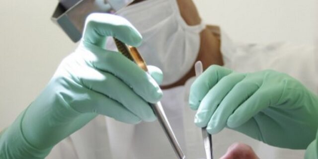 Κινδύνευσε η ζωή τριών ασθενών που επισκέφτηκαν οδοντιάτρους της ΠΓΔΜ, λόγω χαμηλού κόστους