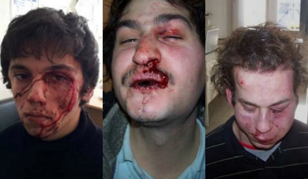 Νέες φωτογραφίες από την κακοποίηση των ληστών στο Βελβεντό