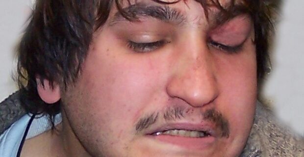 Παραμονές Πρωτοχρονιάς η δεύτερη εμφάνιση του “τοξοβόλου” μετά την απόδραση