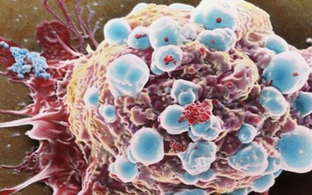 Ελπιδοφόρα έρευνα στις ΗΠΑ: Ενισχυμένα νανοσωματίδια κατά του καρκίνου