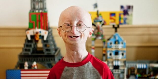 Sam Berns: O κόσμος υποκλίνεται στον 17χρονο που πέθανε από πρόωρη γήρανση και παρέδωσε μαθήματα ζωής