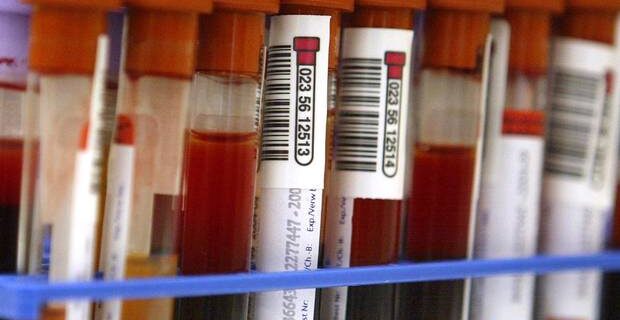 Μάθε πότε θα πεθάνεις με ένα αιματολογικό τεστ