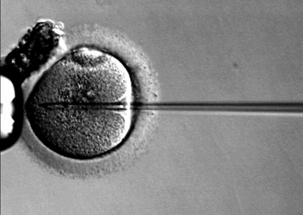 DNA από τρεις βιολογικούς γονείς για το “τέλειο” έμβρυο