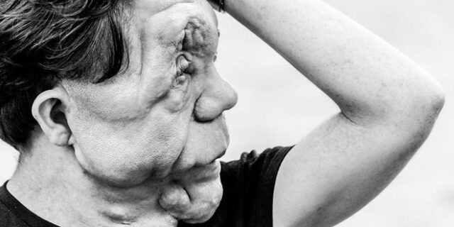 Άνταμ Πίρσον, η ομορφιά είναι κάτω από το δέρμα