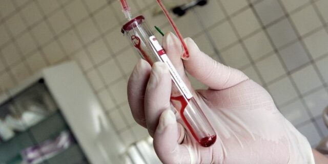 Επέστρεψε ο ιος HIV σε βρέφος που οι γιατροί πίστευαν πως είχε θεραπευτεί