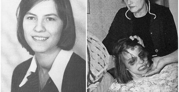 Μηχανή του Χρόνου: Η 24χρονη “δαιμονισμένη” που πέθανε μετά από 67 συνεχόμενους εξορκισμούς