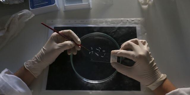 Αναπαράχθηκαν για πρώτη φορά στο εργαστήριο εγκεφαλικά κύτταρα με Αλτσχάιμερ