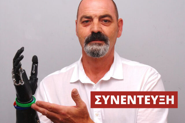 Nigel Ackland: Ο άνθρωπος με το πιο εξελιγμένο βιονικό μέλος στον κόσμο μιλά στο NEWS 247