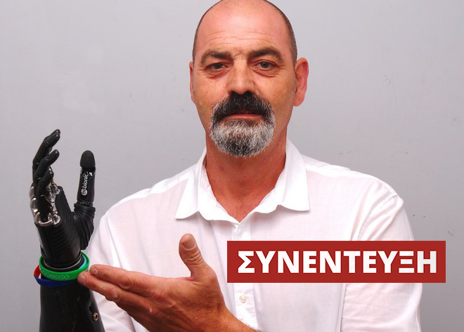 Nigel Ackland: Ο άνθρωπος με το πιο εξελιγμένο βιονικό μέλος στον κόσμο μιλά στο NEWS 247