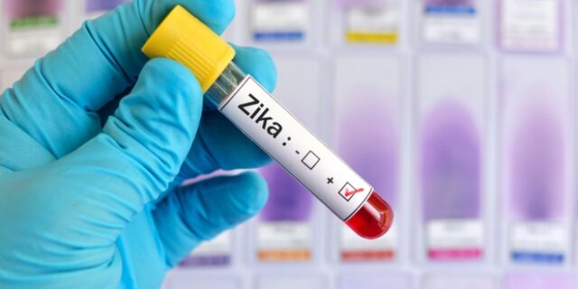 Ιός Ζίκα: Στη Γαλλία το πρώτο κρούσμα από μετάδοση μέσω σεξουαλικής επαφής
