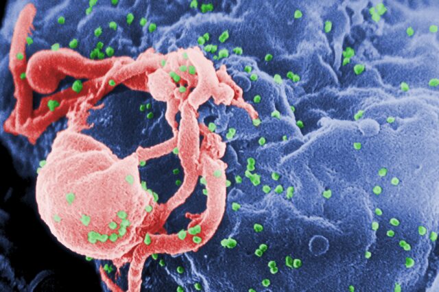 Νέα θεραπεία αντισωμάτων καθυστερεί την επανεμφάνιση του ιού HIV του AIDS