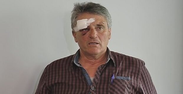 Ιωάννινα: Επιχειρηματίας καταγγέλλει άγριο ξυλοδαρμό από αστυνομικούς