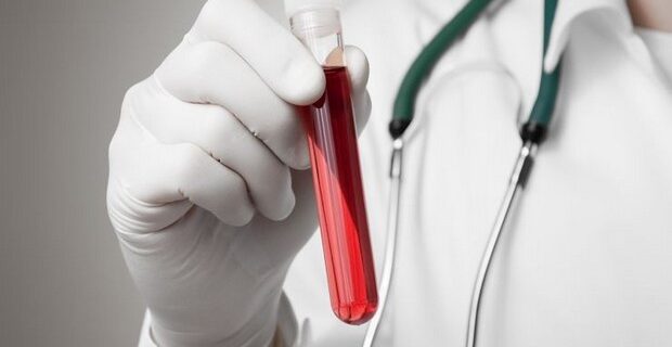 Ανοσοθεραπεία: Καλά νέα για τους ασθενείς HIV με καρκίνο