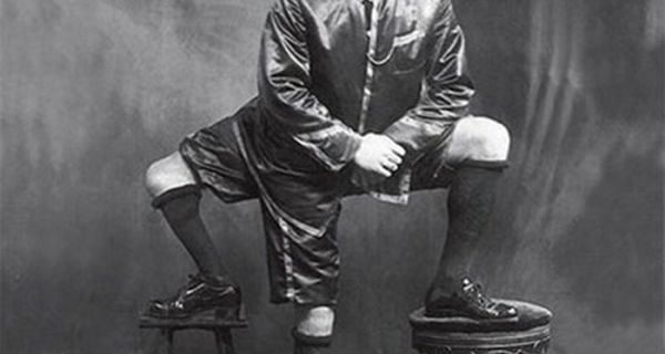 Μηχανή του Χρόνου: Ο άνθρωπος με τα τρία πόδια, τις τέσσερις πατούσες, τα δεκαέξι δάχτυλα και τα δύο γεννητικά όργανα