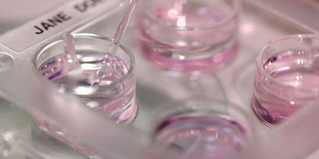 Γεννήθηκε το πρώτο παιδί με μεταφορά μητρικής ατράκτου στην Ελλάδα