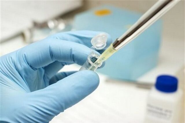 Πρόσβαση στη θεραπεία της Ηπατίτιδας C ζητούν ασθενείς και γιατροί