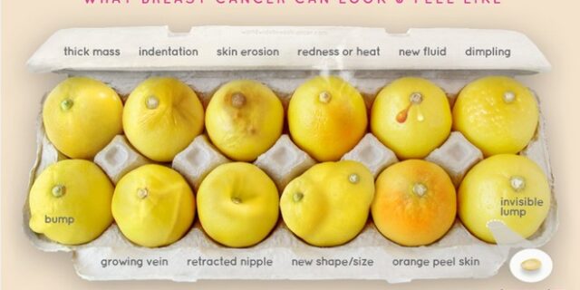 Η φωτογραφία με τα λεμόνια που θα μπορούσε να σώσει ζωές