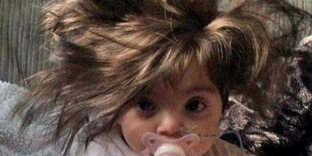 Οκτώ μηνών κοριτσάκι με πλούσια χαίτη 5χρονου!