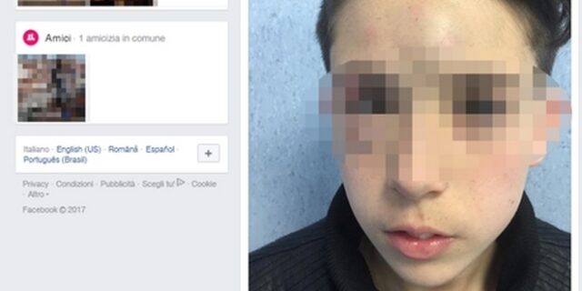 Σάλος: Γονείς ανάρτησαν στο Facebook φωτογραφίες του γιου τους μετά από επίθεση παιδιών