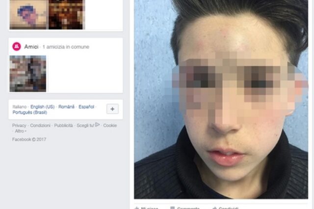 Σάλος: Γονείς ανάρτησαν στο Facebook φωτογραφίες του γιου τους μετά από επίθεση παιδιών