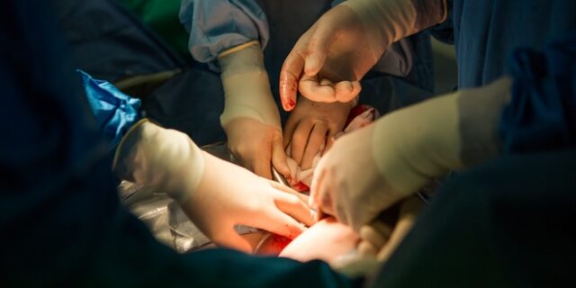 Φρένο στις καισαρικές και ‘αναβαθμισμένες’ μαίες προωθεί το υπουργείο Υγείας