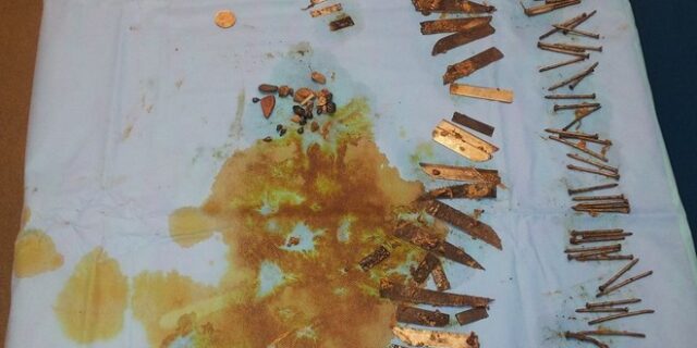 Είχε καταπιεί πάνω από 100 μεταλλικά αντικείμενα