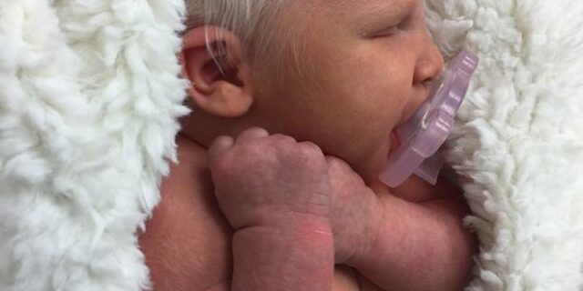 Έσπασε τα social media η ‘αληθινή Χιονάτη’ – Γεννήθηκε με κατάλευκα μαλλιά