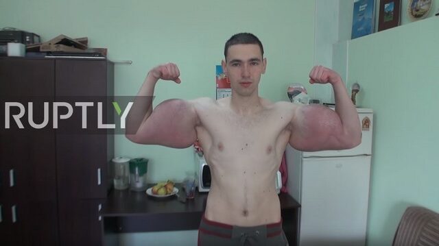 Από εδώ ο 21χρονος Ρώσος ‘Ποπάι’ – Φούσκωσε με παυσίπονα και αλκοόλ