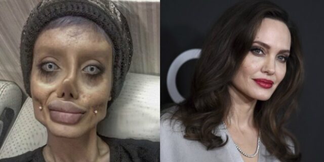 Με make up και photoshop ‘παραμορφώθηκε’ η 19χρονη που ήθελε να μοιάσει στη Τζολί