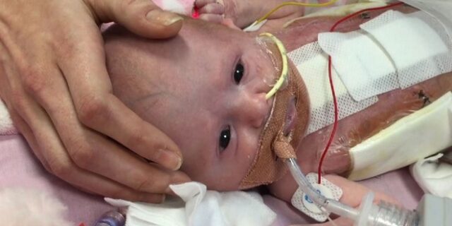 Γνωρίστε τη Βανέλοπι: Η μικρή ηρωίδα που γεννήθηκε με την καρδιά έξω από το σώμα και επέζησε
