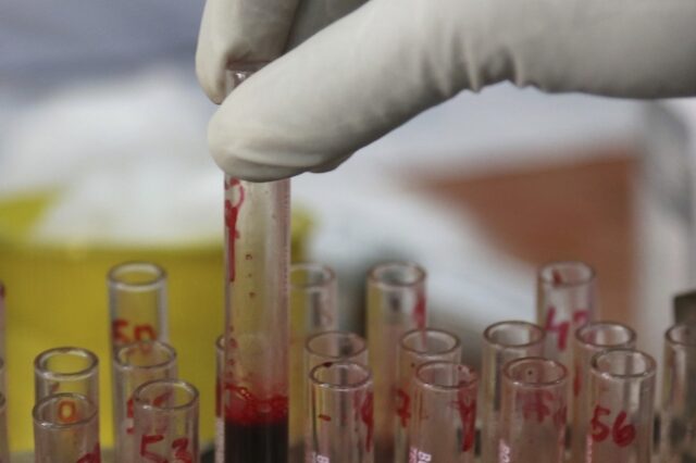 Φιλόδοξο τεστ αίματος για τον καρκίνο με ελληνική υπογραφή