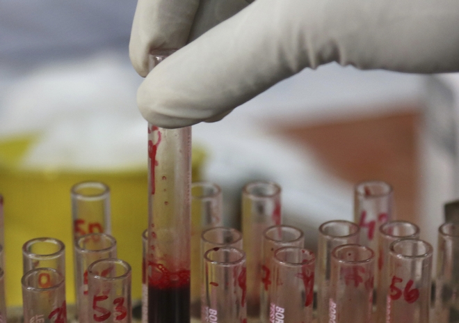 Φιλόδοξο τεστ αίματος για τον καρκίνο με ελληνική υπογραφή