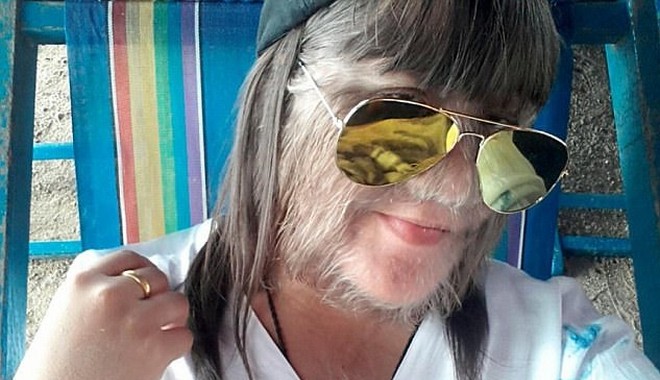 Το ‘πιο τριχωτό κορίτσι στον κόσμο’ ξυρίστηκε και παντρεύτηκε τον έρωτα της ζωής της