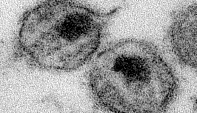 Αυστραλία: O πιο ισχυρός καρκινογόνος ιός απειλεί τους Αβορίγινες