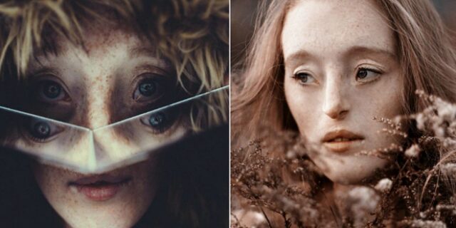 H Γερμανίδα “νεράιδα” με τη σπάνια πάθηση που καταρρίπτει τα στερεότυπα ομορφιάς