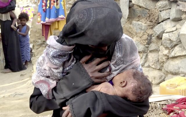 Υεμένη: 5,2 εκατ. παιδιά κινδυνεύουν να λιμοκτονήσουν στην Υεμένη