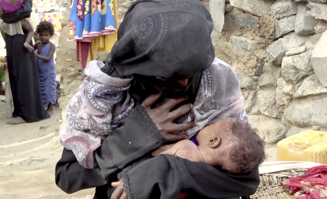 Υεμένη: 5,2 εκατ. παιδιά κινδυνεύουν να λιμοκτονήσουν στην Υεμένη
