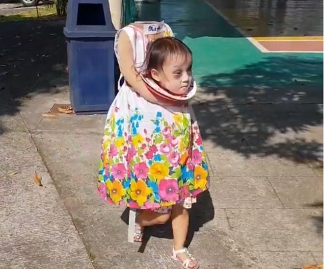 Αυτό είναι το “ακέφαλο” κοριτσάκι που έγινε viral το φετινό Halloween