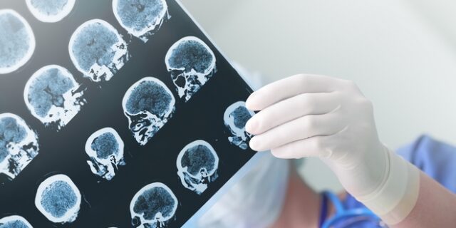 Τα δέκα νέα πράγματα που μάθαμε για τον εγκέφαλο το 2018