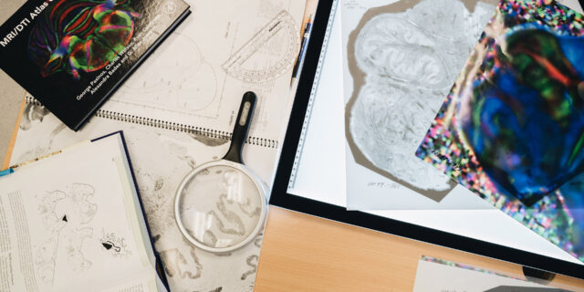 Τρεις επαναστατικές ιατρικές ανακαλύψεις του 2018: Και είναι και οι τρεις ελληνικές