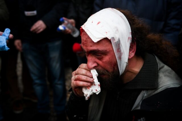 Συλλαλητήριο για το Μακεδονικό: Φασιστικές επιθέσεις σε δημοσιογράφους