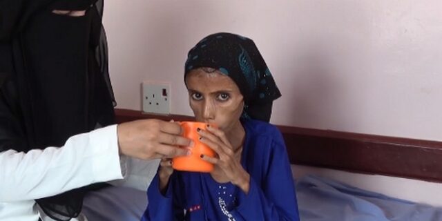 Υεμένη: Το αμείλικτο πρόσωπο ενός “άγνωστου” πολέμου – 12χρονη ζυγίζει 10 κιλά