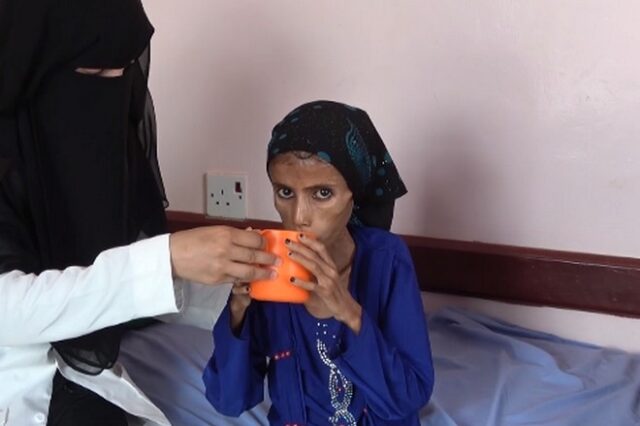 Υεμένη: Το αμείλικτο πρόσωπο ενός “άγνωστου” πολέμου – 12χρονη ζυγίζει 10 κιλά