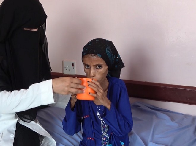 Υεμένη: Το αμείλικτο πρόσωπο ενός “άγνωστου” πολέμου – 12χρονη ζυγίζει 10 κιλά