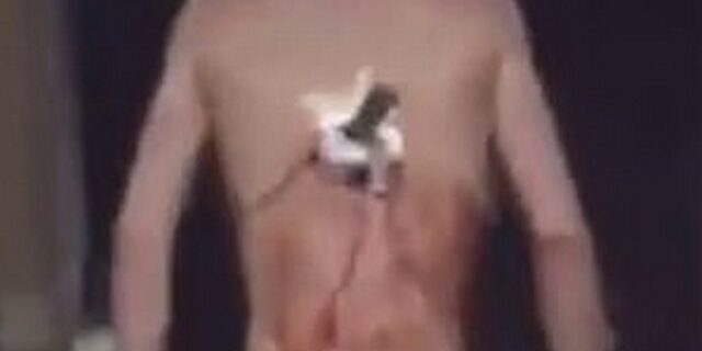 Βίντεο: Τραυματίας με μαχαίρι καρφωμένο στην πλάτη βγαίνει από το νοσοκομείο για να καπνίσει