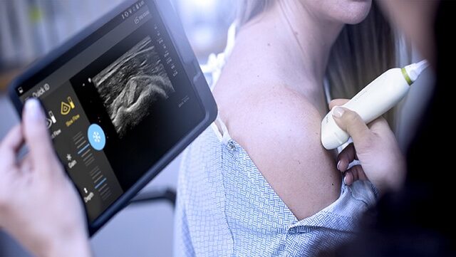 Ο νέος φορητός τηλε-υπέρηχος Lumify της Philips “εκμηδενίζει” τις αποστάσεις στην υγεία