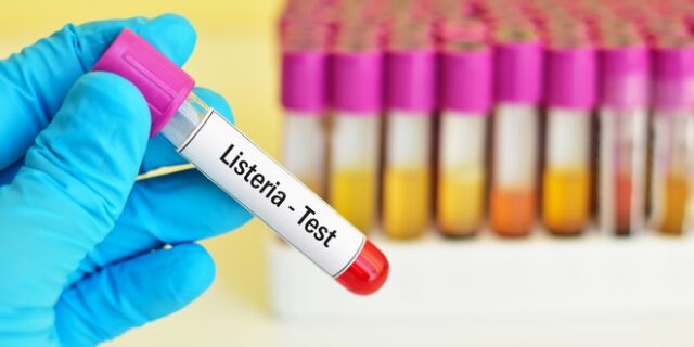 Λιστερίωση: Η επικίνδυνη βακτηριακή λοίμωξη – Ποια τα συμπτώματα
