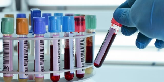 Διαγνωστικά κέντρα: Το πρωί της Τετάρτης κρίνεται το μέλλον των κινητοποιήσεων