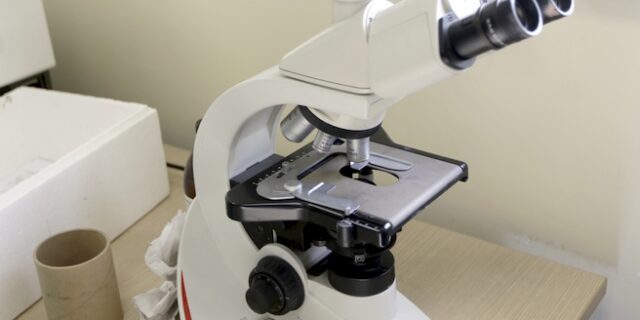 Εξέταση αίματος εντοπίζει τον καρκίνο των ωοθηκών έως και δύο χρόνια νωρίτερα