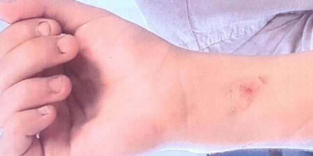 Υπόθεση Μποτρίνι: Εισαγγελική έρευνα για τις καταγγελίες του 19χρονου σπουδαστή